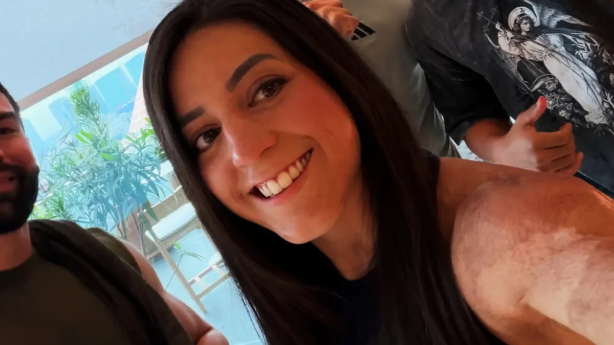 Quién es Mariana Khalil y qué le pasó en la piel
